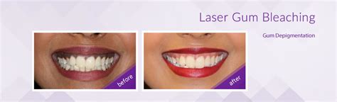 smile bdscr|Dream Smile Dental Clinic .